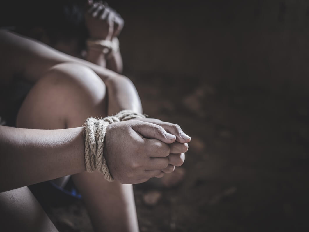 Bruised hands of female human trafficking victim in captivity